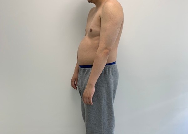 30代 男性のビフォー画像