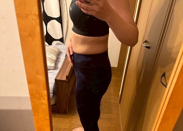 30代 女性のビフォー画像